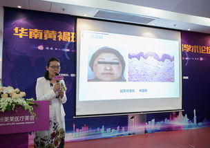 廣州美萊首推簽約祛斑責任制 助祛斑失敗毀容女士修復治療